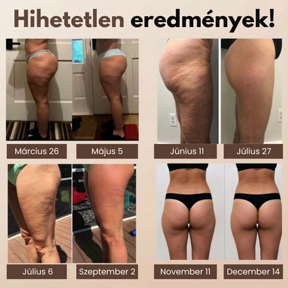 3D Cellulit Elleni Alakformáló Legging
